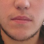 Antes
